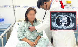 Đột ngột khó thở, cô gái 27 tuổi nhập viện phát hiện u quái trung thất