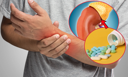 Uống thuốc xương khớp mua trên mạng 3 tháng, người đàn ông suy tuyến thượng thận 