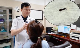 Bắt đỉa sống trong thanh quản người phụ nữ có thói quen uống nước ở suối