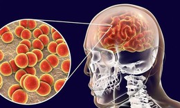 Sau chùm ca bệnh nhiễm não mô cầu tại trường học ở TP. HCM, Bộ Y tế khuyến cáo gì?