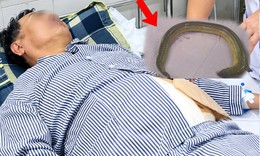 Người đàn ông 55 tuổi đau bụng dữ dội, bác sĩ gắp lươn sống dài 65 cm