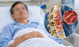 Cúm mãi không khỏi, người đàn ông 60 tuổi 'chết lặng' khi đi khám