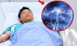 Bị sét đánh ngừng tim, thiếu niên 14 tuổi thoát cửa tử  sau 30 phút cấp