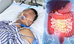 Rối loạn tiêu hóa suốt 2 tuần, người đàn ông bàng hoàng phát hiện ung thư