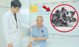 Co giật nhiều lần, người phụ nữ 41 tuổi phát hiện u não như quả trứng gà