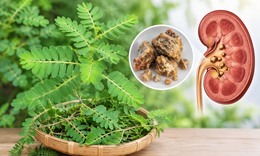 Cách dùng cây chó đẻ hỗ trợ điều trị sỏi tiết niệu