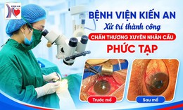 Bảo tồn thị lực cho bệnh nhân bị mảnh bát vỡ đâm xuyên nhãn cầu