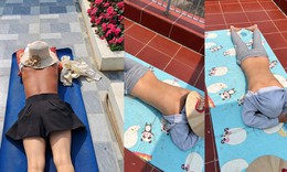 Sau 'chanh liều cao' lại xuất hiện hội 'thích phơi nắng': Cẩn thận ung thư da
