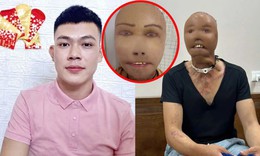 Ngã úp mặt vào nước sôi, chàng trai 31 tuổi mất thị lực, gương mặt biến dạng
