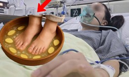 Ngâm chân bằng nước gừng nóng, người phụ nữ suýt phải cắt cụt chân 