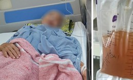 Bác sĩ hút 2,5 lít dịch mỗi ngày từ lồng ngực cụ bà
