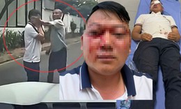 Vợ tài xế bị đánh gục giữa đường ở Phú Thọ tiết lộ thương tích của chồng