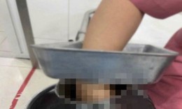 Nữ nhân viên nấu ăn ở trường học bị bàn tay phải cuốn vào máy xay thịt