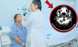 Đau đầu, chảy nước mũi suốt nhiều tháng, cô gái 24 tuổi sốc nặng khi đi khám