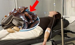 Gia đình 3 người nhập viện sau ăn khuya, nguyên nhân từ 2 món ăn quen thuộc