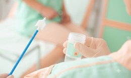 Các phương pháp phát hiện sớm ung thư cổ tử cung độ chính xác cao