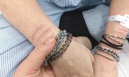 Khi con tự làm đau bản thân: Cha mẹ cần làm gì?