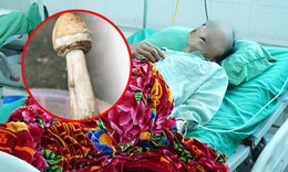 4 người trong một gia đình nhập viện sau bữa cơm có nấm lạ