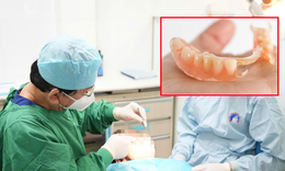 Dùng hàm giả nhiều năm, người phụ nữ 64 tuổi gặp biến chứng nguy hiểm 