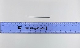 Lấy thành công kim khâu dài 6 cm nằm trong gan người đàn ông 