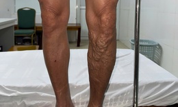 Đừng để 'đôi chân mệt mỏi' cướp mất niềm vui đón Xuân