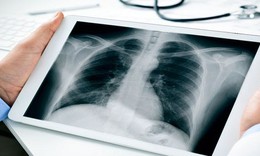 Bộ Y tế đề nghị thanh toán BHYT kỹ thuật điện quang không phụ thuộc vào thời gian chụp chiếu