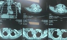 Chẩn đoán hình ảnh không cần phim in vào Quỹ BHYT chi trả