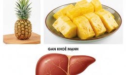 3 thay đổi bất ngờ của cơ thể khi ăn dứa thường xuyên