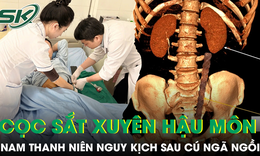 Nam thanh niên bị cọc sắt xuyên qua hậu môn sau cú ngã ngồi 