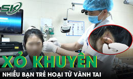 Xỏ khuyên, nhiều bạn trẻ nhập viện vì hoại tử vành tai 