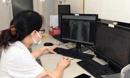 Dịch vụ chẩn đoán hình ảnh không phim được BHYT chi trả, giúp tiết kiệm, thuận tiện cho người bệnh