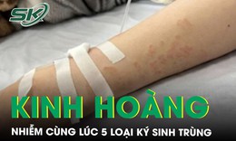Người phụ nữ nhiễm cùng lúc 5 loại ký sinh trùng
