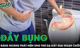 Thường xuyên đầy bụng, nam thanh niên bàng hoàng phát hiện ung thư dạ dày giai đoạn cuối