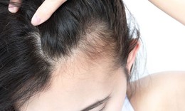 2 bước chăm sóc tóc mọc nhanh, dày