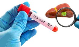 Cách dùng cần tây hỗ trợ giảm axit uric tại nhà: Lợi ích và những điều cần lưu ý