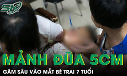 Gắp mảnh đũa gãy dài 5cm trong mắt bé trai 7 tuổi 