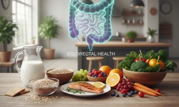 4 loại thực phẩm có thể giúp giảm nguy cơ ung thư đại trực tràng