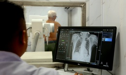 Phát hiện sớm để chặn nguồn lây bệnh lao trong cộng đồng