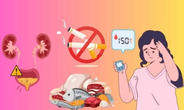 3 thói quen âm thầm hủy hoại thận: Đến khi phát hiện đã quá muộn