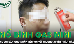 Người đàn ông nhập viện với vết thương xuyên nhãn cầu do bình gas mini phát nổ