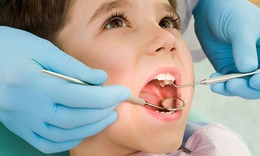 Trẻ sâu răng khi nào cần điều trị gây mê?
