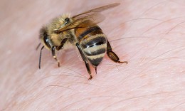 Những sai lầm nguy hiểm cần tránh khi bị ong đốt