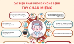Các biện pháp phòng chống bệnh tay chân miệng