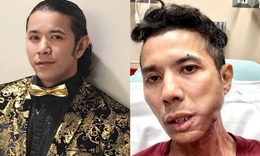 Kasim Hoàng Vũ qua đời sau thời gian bạo bệnh