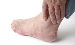 Sai lầm thường gặp chấn thương phần mềm cổ chân