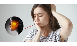 Dinh dưỡng hỗ trợ phòng ngừa biến chứng của viêm khớp thái dương hàm