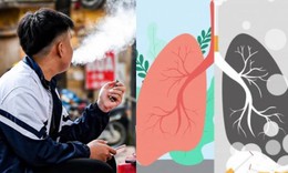 Sửa luật để chặn 'làn sóng nghiện' thuốc lá mới 