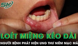 Loét miệng kéo dài, người bệnh phát hiện ung thư niêm mạc má