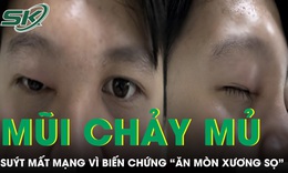 Mũi chảy mủ 4 ngày, nam thanh niên 20 tuổi suýt mất mạng