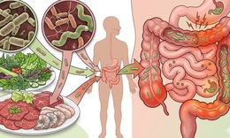 Dễ mắc nhiễm khuẩn đường ruột trong mùa hè từ thói quen ăn đồ sống